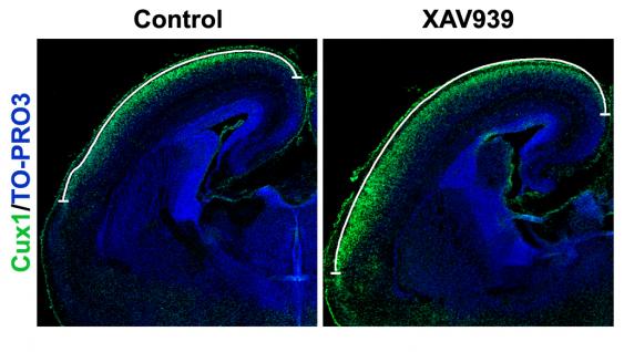  图 中 绿 色 的 部 分 代 表 小 鼠 大 脑 皮 质 的 上 层 神 经 细 胞 。 与 正 常 大 脑 相 比 ， 通 过 化 合 物XAV939增 加Axin蛋 白 含 量 将 导 致 大 脑 皮 质 的 表 面 积 显 著 扩 大。