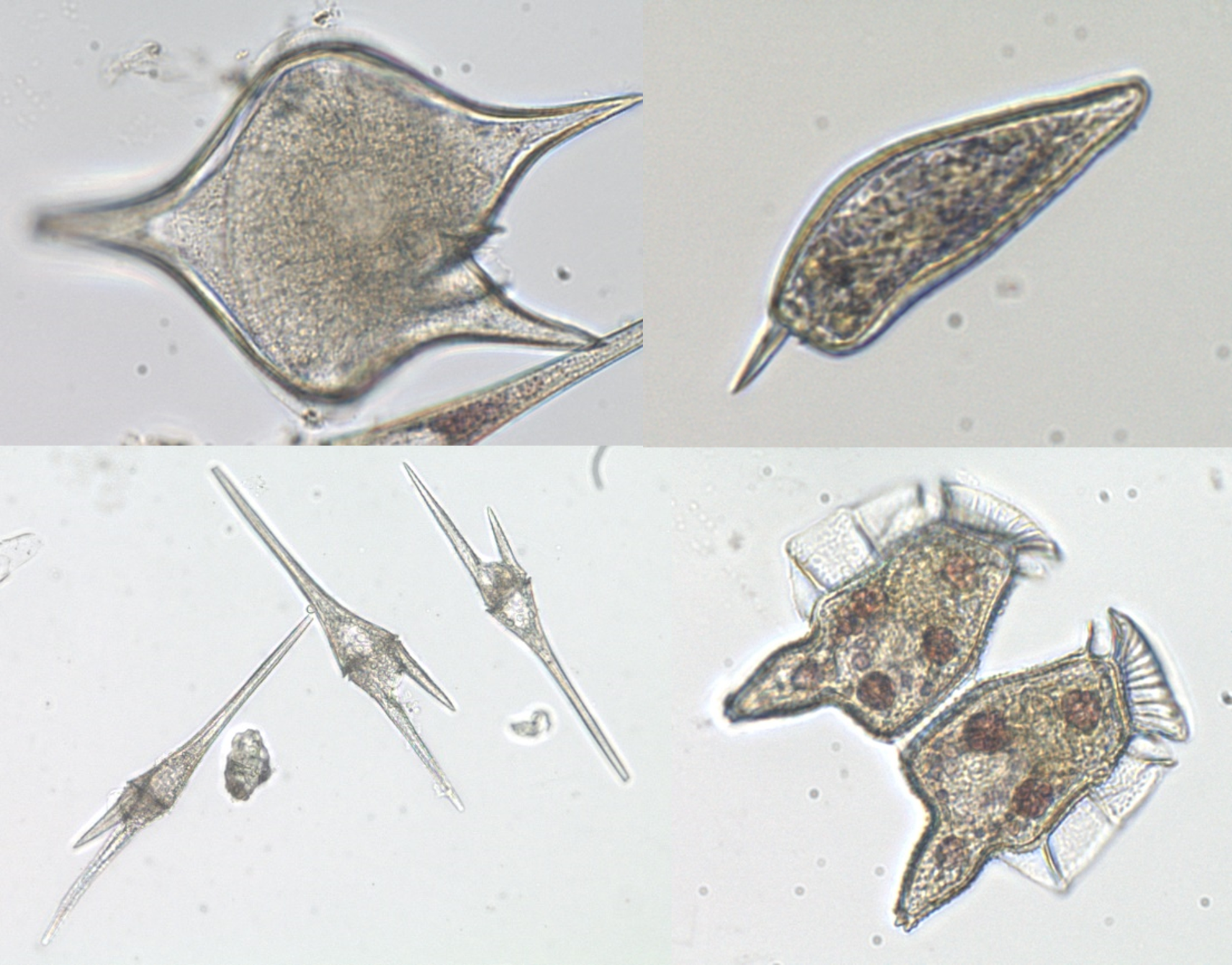Microscopic images of dinoflagellates