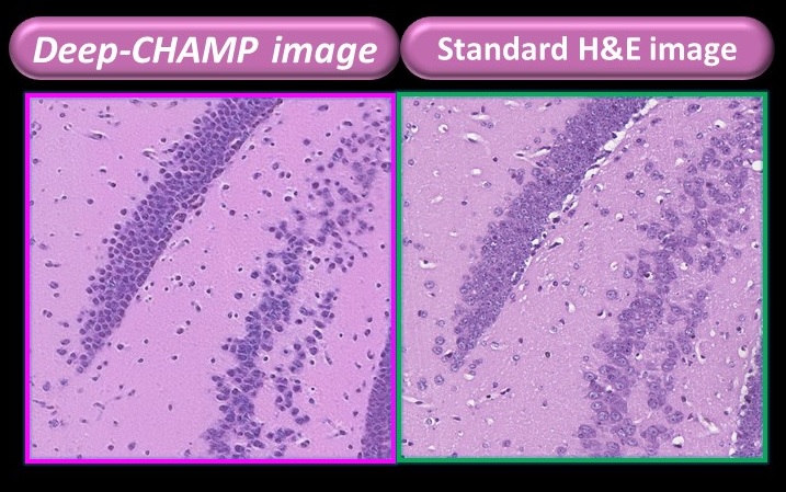 (左圖)遨天醫療科技顯微鏡所呈現的細胞圖像與(右圖)現存標準細胞顯影技術。前者只需3分鐘即可完成細胞成像, 後者則須用福馬林固定後包裹在石蠟塊中的細胞樣本方可成像, 約需一周。