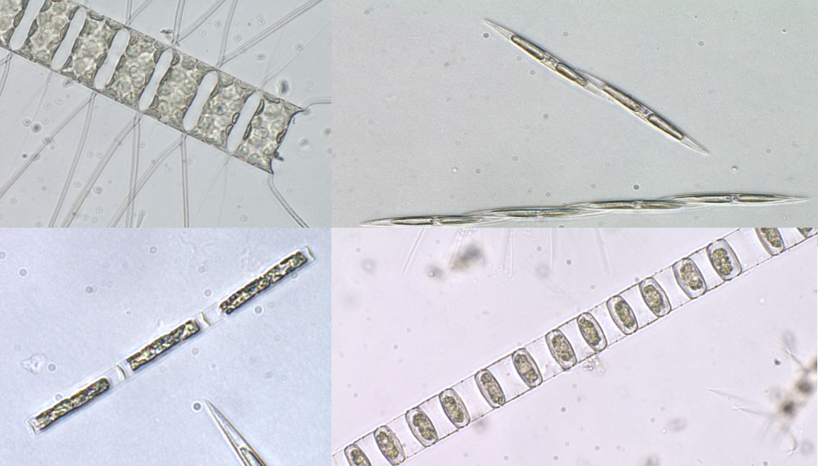 Microscopic images of diatoms